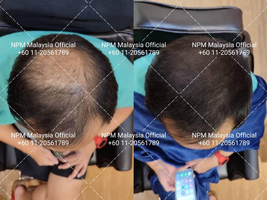 NPM Malaysia Official (HQ) – Logo dan Identiti Korporat, Pusat Operasi