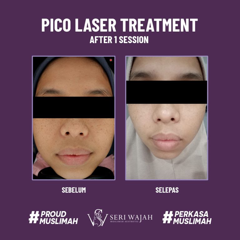 Seri Wajah Muslimah: Facial Spa Halal Premium di Pasir Gudang – Perawatan Kulit Sinaran